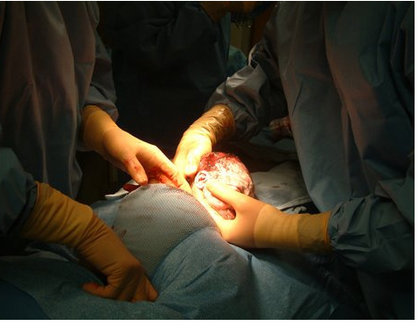 Large_rsz_c-section